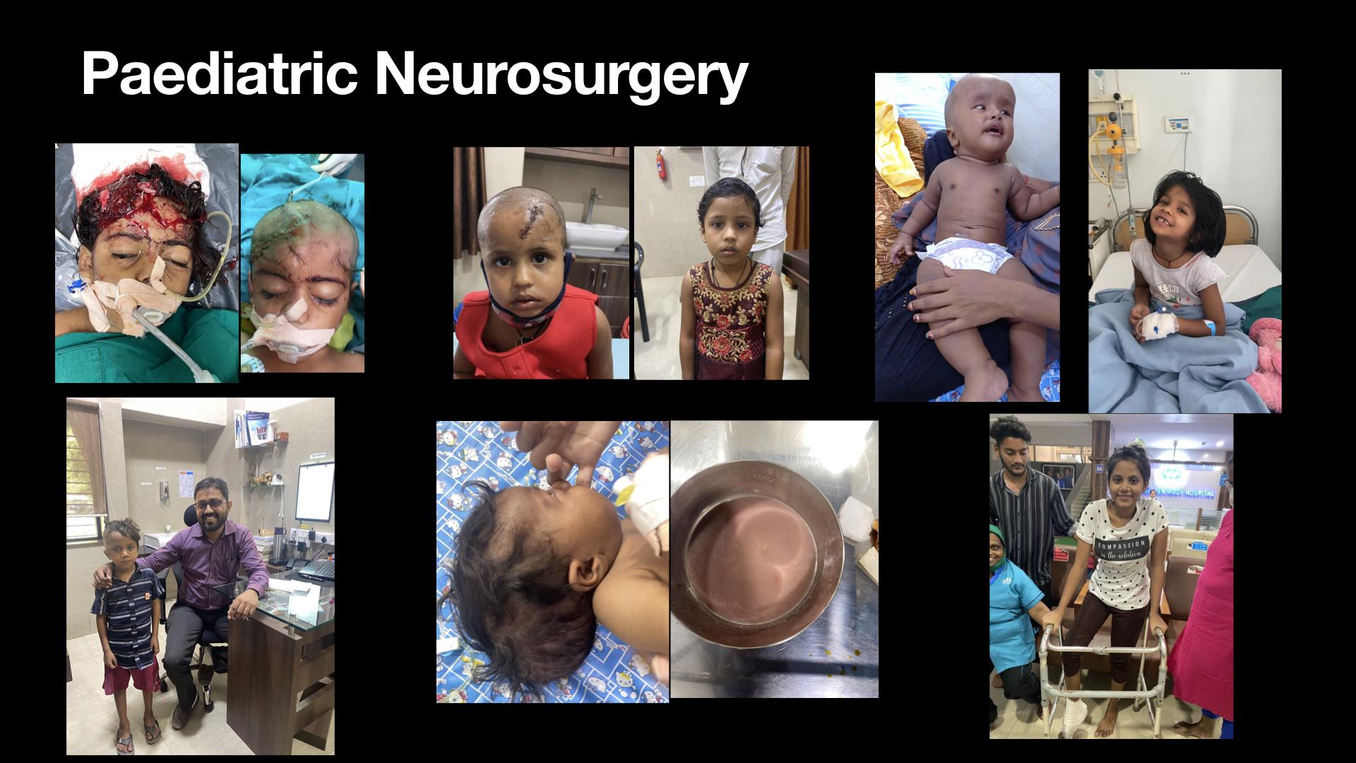 Ankleshwar Vascular Neurosurgery Center
                                    
