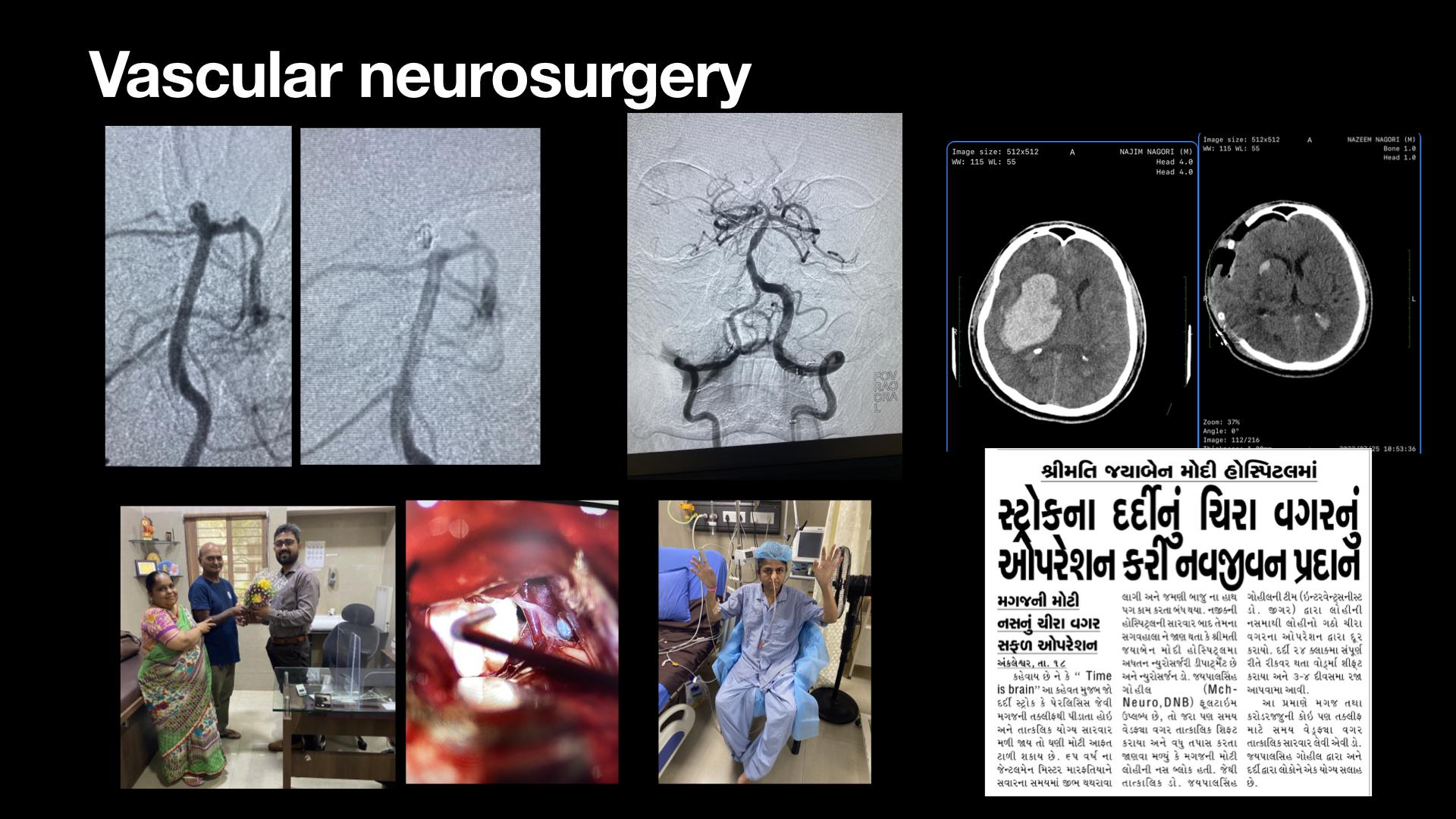 Ankleshwar Spine Tumor Specialist
                                    